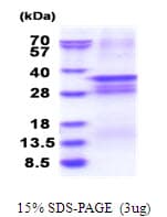 Human OSR2 Protein (Recombinant His)