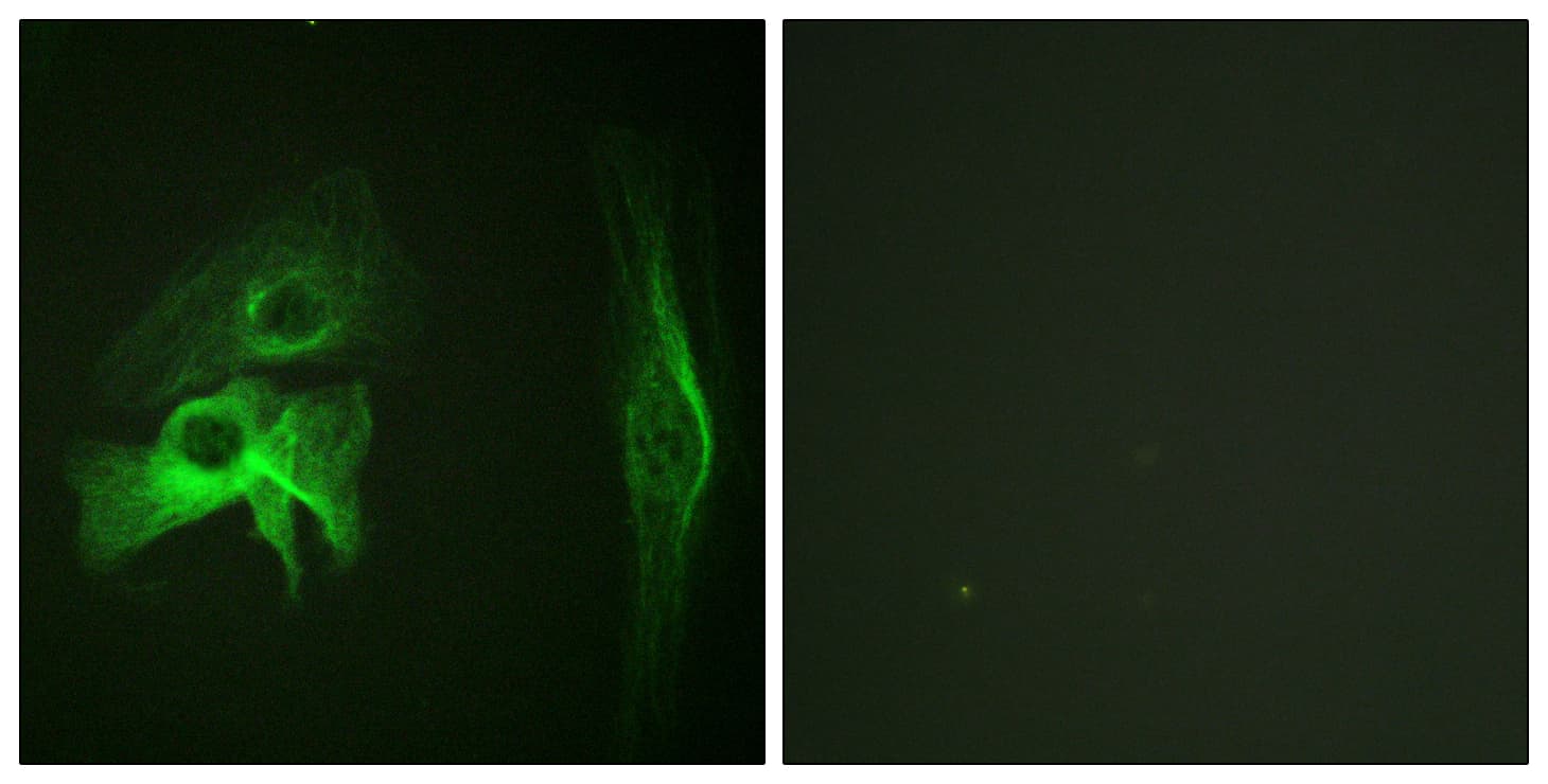 IHC-plus™ PAK1 Antibody (aa178-227)