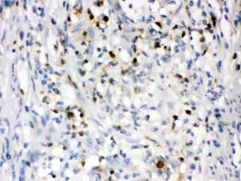 Polyclonal Rabbit anti-Human LCN2 / Lipocalin 2 / NGAL Antibody (IHC, WB)