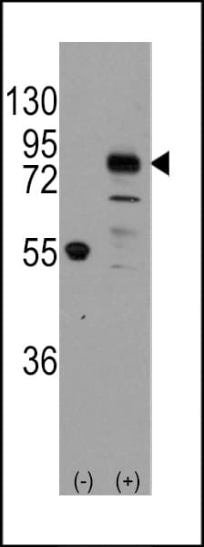 IHC-plus™ CDH9 / Cadherin 9 Antibody (aa701-729)