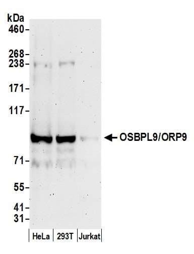 OSBPL9 Antibody (aa250-300)