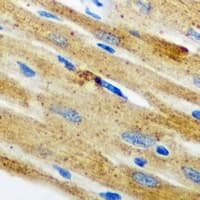 NOL3 / ARC Antibody