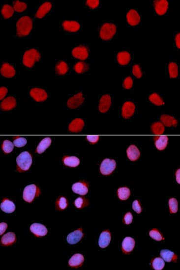 MCM6 Antibody