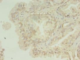 HNRNPL / hnRNP L Antibody (aa89-335, FITC)