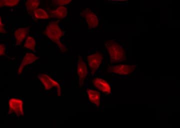 PTPN22 / PEP Antibody