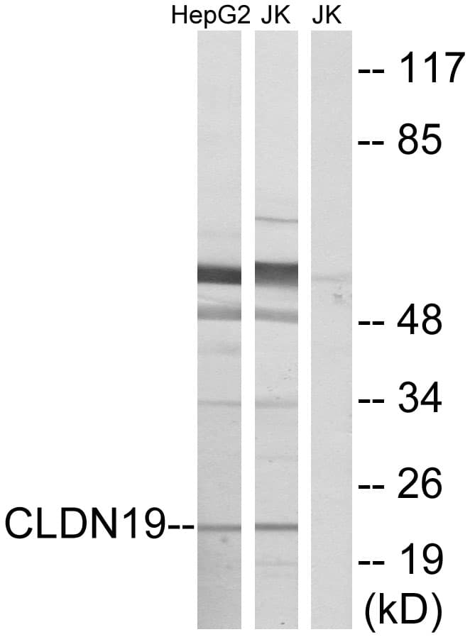Polyclonal Rabbit anti-Human CLDN19 / Claudin 19 Antibody (aa81-130, WB)