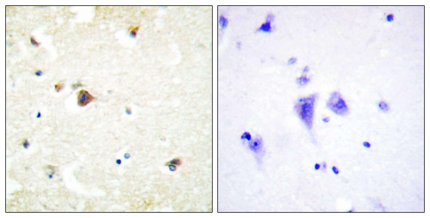 Polyclonal Rabbit anti-Human TRIM3 Antibody (aa1-50, IHC, IF, WB)