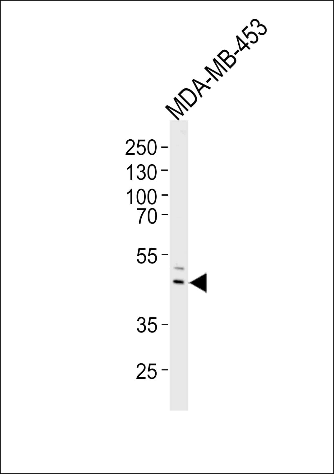IL5RA / CD125 Antibody (aa49-76)