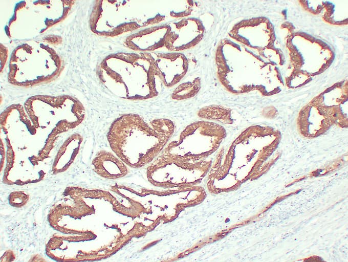 Monoclonal Mouse anti-Human ACPP / PAP Antibody (clone ABT-PSAP, IHC)