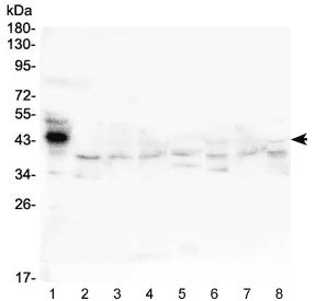 HP / Haptoglobin Antibody