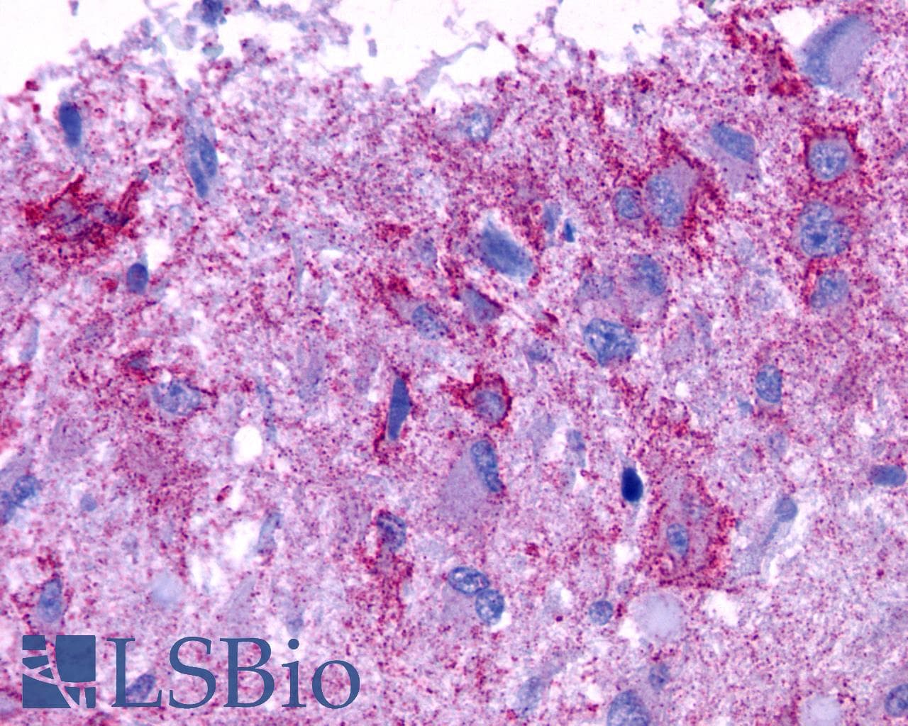 PathPlus™ GPCR6 / GPR101 Antibody (Cytoplasmic Domain)