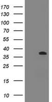 Monoclonal Mouse anti-Human BCL10 / BCL-10 Antibody (clone OTI6A8, IHC, WB)