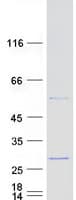 Human RPL18 / Ribosomal Protein L18 (Recombinant Myc-DDK (Flag))