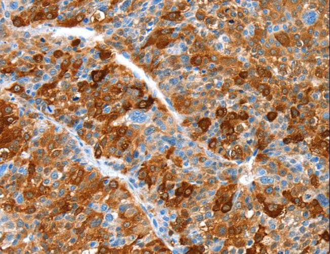 ALDOB Antibody