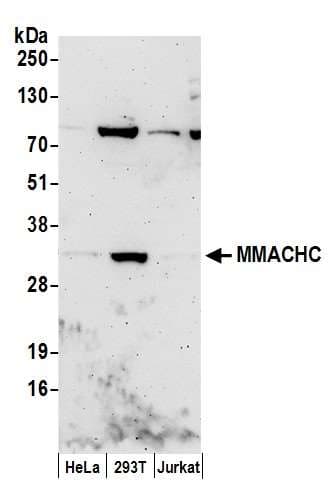 MMACHC Antibody (aa175-225)