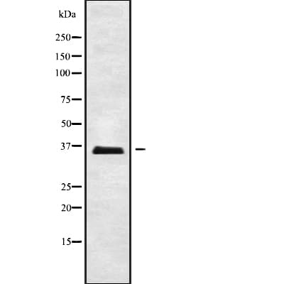 ELOVL2 Antibody