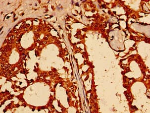 Polyclonal Rabbit anti-Human TFAP2C / AP2 Gamma Antibody (IHC)