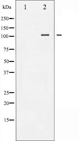 PRKD1 / PKC Mu Antibody