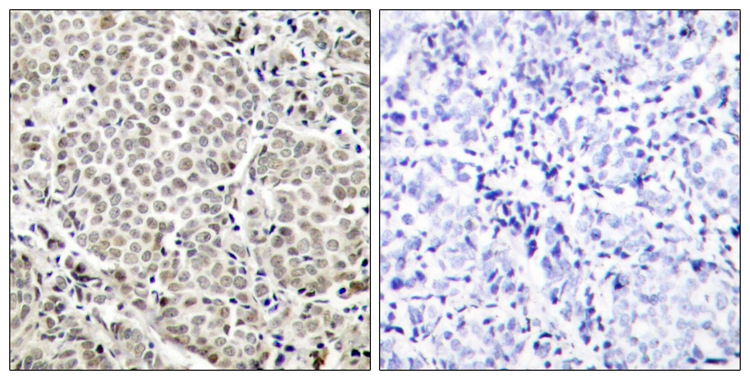 Polyclonal Rabbit anti-Human RELA / NFKB p65 Antibody (phospho-Ser529, IHC, WB)