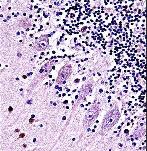Polyclonal Rabbit anti-Human TRPC5 Antibody (aa254-283, IHC, WB)