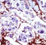 CMPK / CMPK1 Antibody (aa132-162)