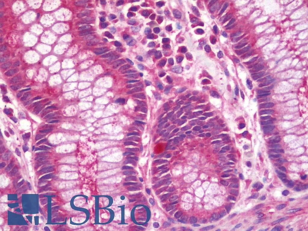VTCN1 / B7-H4 Antibody (HRP)