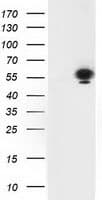 TP53 / p53 Antibody (clone OTI5E2)