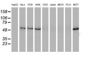 SQSTM1 Antibody (clone OTI7F6)