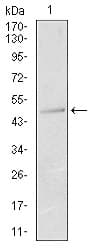 IHC-plus™ KRT13 / CK13 / Cytokeratin 13 Antibody (clone 3G4)