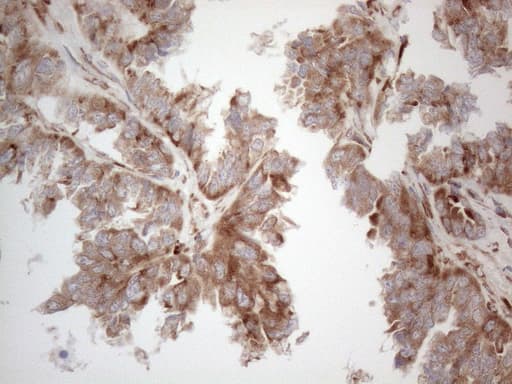 JAG1 / Jagged 1 Antibody (aa523-759, clone OTI3A10, Carrier-free)
