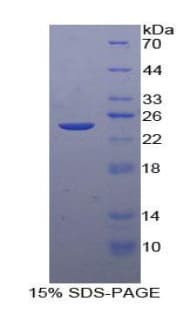 Human FCGR3B / CD16B Protein (Recombinant His-T7)