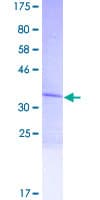 Human LCE1C Protein (Recombinant GST)