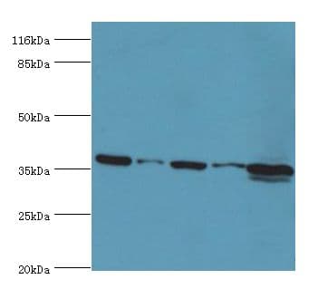 MAS1 / MAS Antibody (aa285-352)