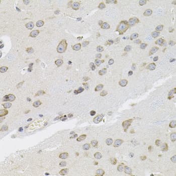 VEPH1 Antibody
