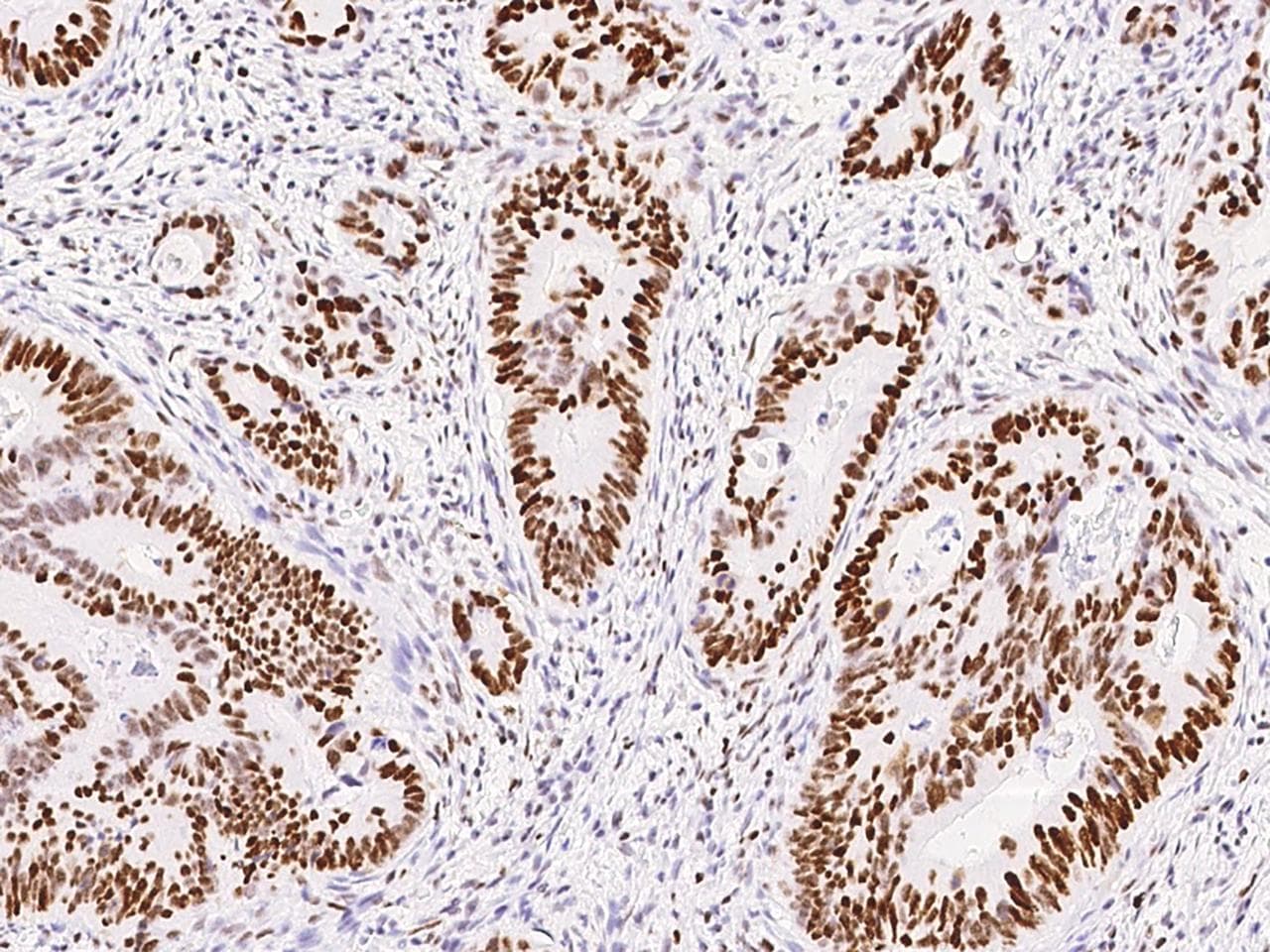 MSH6 Antibody (clone 021, Preservative Free)
