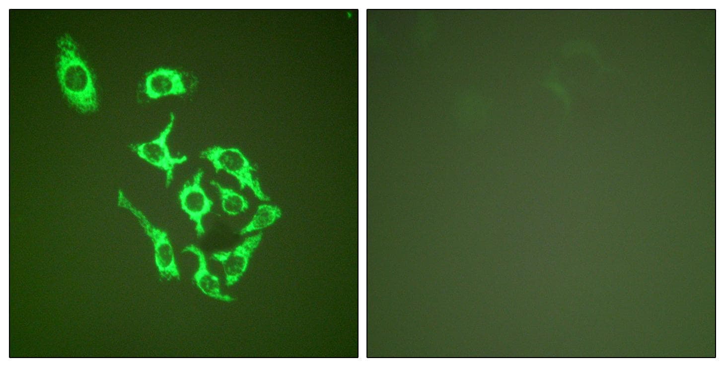 Polyclonal Rabbit anti-Human HSPD1 / HSP60 Antibody (IHC, IF, WB)