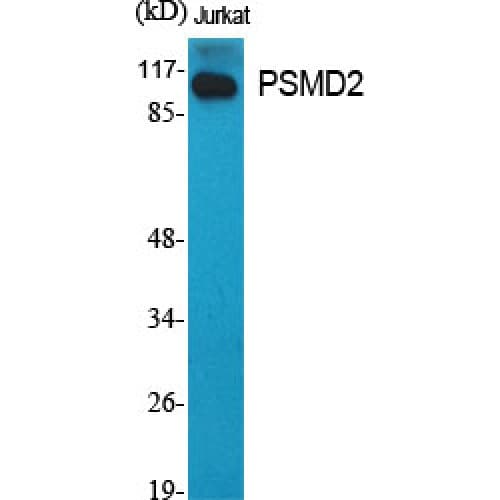Polyclonal Rabbit anti-Human PSMD2 Antibody (70-150 aa, N-terminal, IHC, WB)