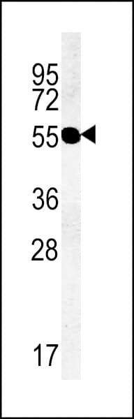 TMEM79 Antibody (aa362-391)