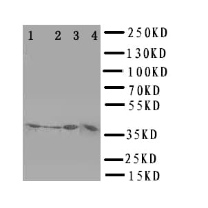 CD1D Antibody (aa76-92)
