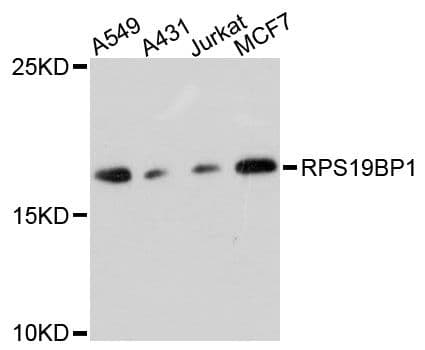 Polyclonal Rabbit anti-Human RPS19BP1 Antibody (WB)