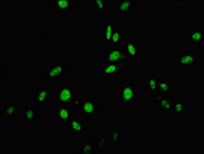 Polyclonal Rabbit anti-Human USP22 Antibody (IHC, IF)