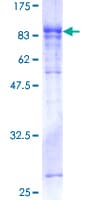 Human GBP5 Protein (Recombinant GST)