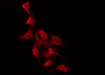 Polyclonal Rabbit anti-Human PRKCZ / PKC-Zeta Antibody (phospho-Thr560, IHC, IF, WB)