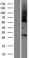 Human FAM86B1 Protein (Over-Expression Lysate Myc-DDK (Flag))