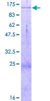 Human HDX Protein (Recombinant GST)