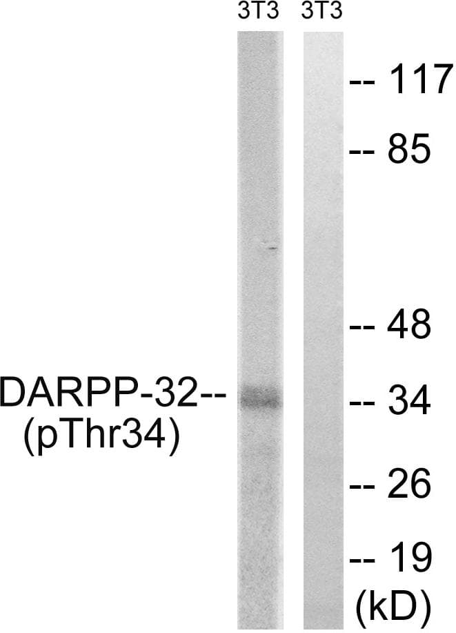 PPP1R1B / DARPP-32 Antibody (phospho-Thr34)