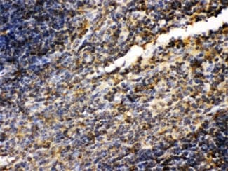 TGM2 / Transglutaminase 2 Antibody
