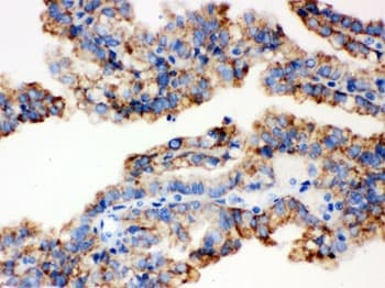 Polyclonal Rabbit anti-Human ALDH2 Antibody (IHC, WB)