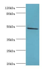 Polyclonal Rabbit anti-Human HYAL1 Antibody (aa136-435, IHC, WB)