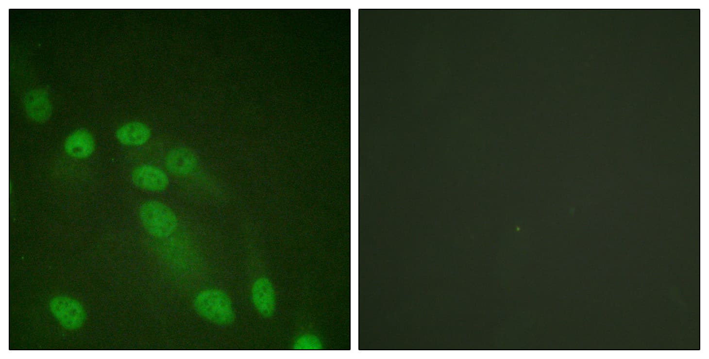 IHC-plus™ RELA / NFKB p65 Antibody (aa275-324)